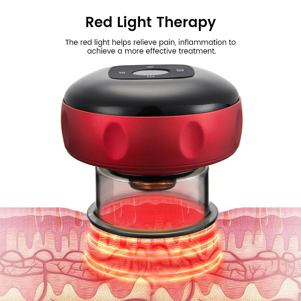 Electric Cupping Therapy Jar